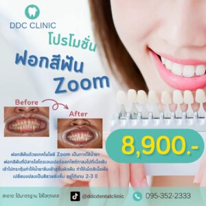 LINE_ALBUM_ฟอกสีฟัน_๒๓๑๐๒๗_3