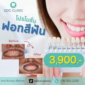 LINE_ALBUM_ฟอกสีฟัน_๒๓๑๐๒๗_4